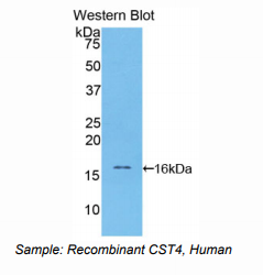 https://msimg.bioon.com/bionline/goods-no-pic.png