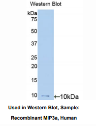 https://msimg.bioon.com/bionline/goods-no-pic.png