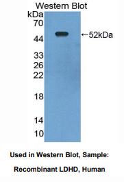 人乳酸脱氢酶D(LDHD)多克隆抗体