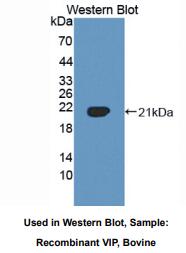 牛血管活性肠肽(VIP)多克隆抗体