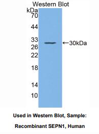 https://msimg.bioon.com/bionline/goods-no-pic.png