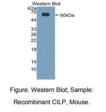 小鼠软骨中间层蛋白(CILP)多克隆抗体