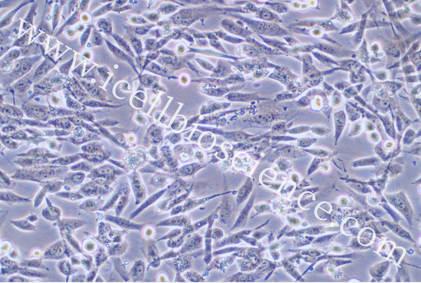HS-5细胞/HS5细胞/HS-5/HS5/人骨髓基质细胞