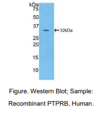 人蛋白酪氨酸磷酸酶受体B(PTPRB)多克隆抗体