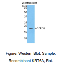 大鼠角蛋白6A(KRT6A)多克隆抗体