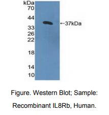 人白介素8受体β(IL8Rb)多克隆抗体