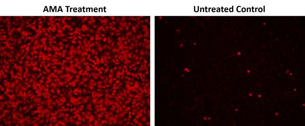 https://img.medsci.cn/e73eefcea40976357f460123cbf1e819c54e5106c9b457225be13b1cbc991aff.png