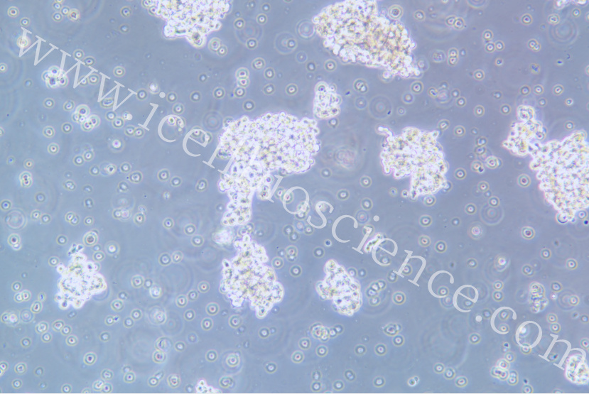 NCI-H146细胞/NCI-H146细胞/NCI-H146细胞/NCI-H146细胞/人小细胞肺癌细胞