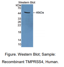 人跨膜丝氨酸蛋白酶4(TMPRSS4)多克隆抗体