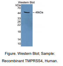 https://msimg.bioon.com/bionline/goods-no-pic.png