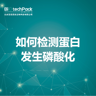https://msimg.bioon.com/bionline/goods-no-pic.png