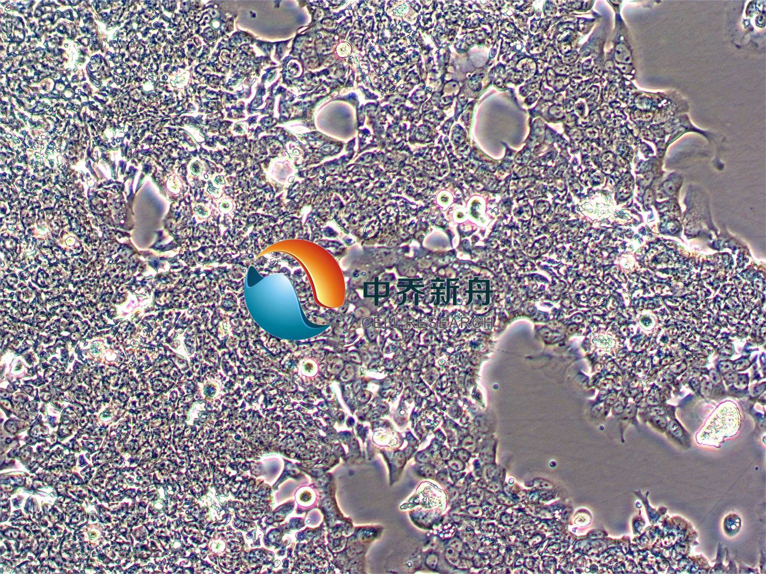 https://img.medsci.cn/8eee53bbc4cb7a98de615e72115896bc4e27fda5cbb764dbd67d9d641c2bb46a.png