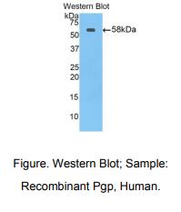 https://msimg.bioon.com/bionline/goods-no-pic.png