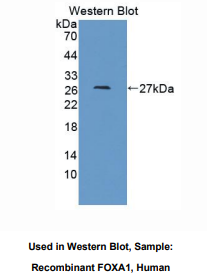 人叉头框蛋白A1(FOXA1)多克隆抗体