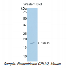 小鼠复合素2(CPLX2)多克隆抗体