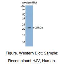 https://msimg.bioon.com/bionline/goods-no-pic.png