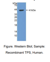 https://msimg.bioon.com/bionline/goods-no-pic.png