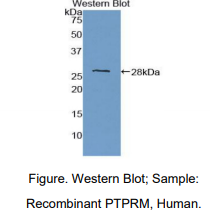 人蛋白酪氨酸磷酸酶受体M(PTPRM)多克隆抗体