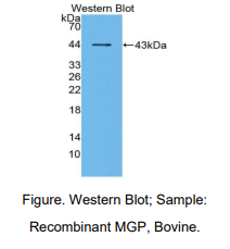 牛基质Gla蛋白(MGP)多克隆抗体