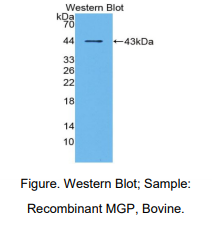 https://msimg.bioon.com/bionline/goods-no-pic.png