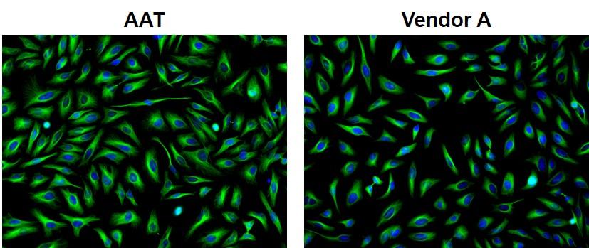 https://img.medsci.cn/e73eefcea40976357f460123cbf1e819c54e5106c9b457225be13b1cbc991aff.png