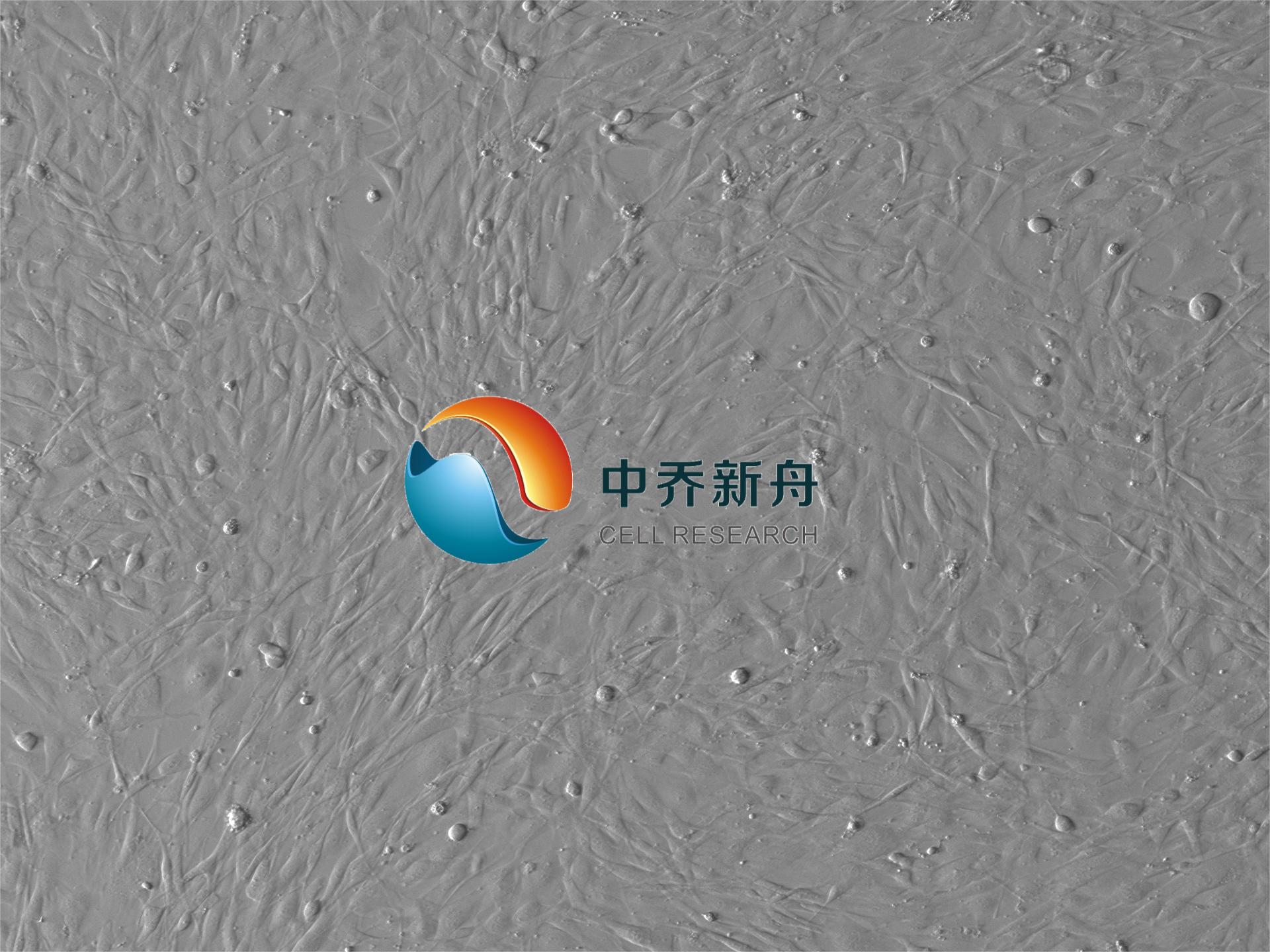 人结肠癌肿瘤组织纤维细胞永生化