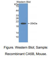 小鼠碳酸酐酶ⅤB(CA5B)多克隆抗体