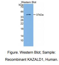 https://msimg.bioon.com/bionline/goods-no-pic.png