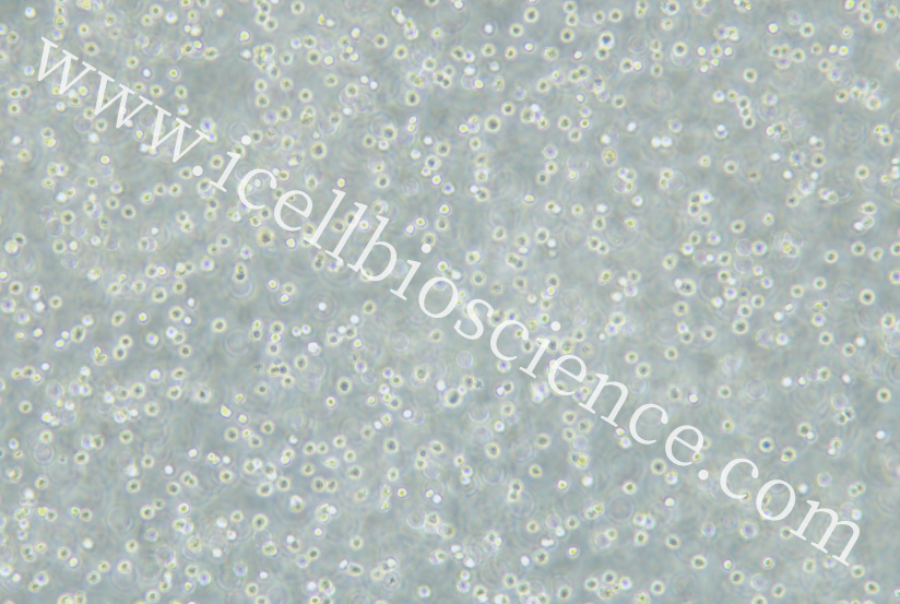 MOLM-13细胞/MOLM13细胞/MOLM-13/MOLM13/人急性髓性白血病细胞