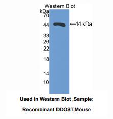 小鼠多萜醇二磷酸寡糖蛋白环糊精糖基转移酶(DDOST)多克隆抗体