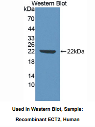 https://msimg.bioon.com/bionline/goods-no-pic.png