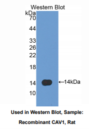 https://msimg.bioon.com/bionline/goods-no-pic.png