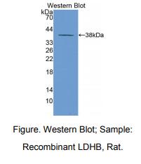 大鼠乳酸脱氢酶B(LDHB)多克隆抗体