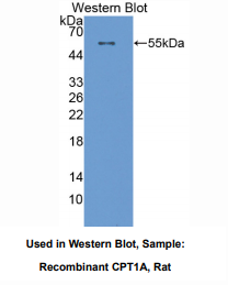 https://msimg.bioon.com/bionline/goods-no-pic.png