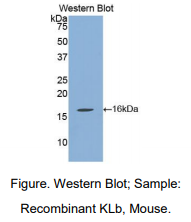 https://msimg.bioon.com/bionline/goods-no-pic.png