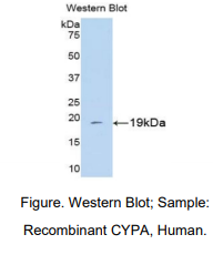 https://msimg.bioon.com/bionline/goods-no-pic.png