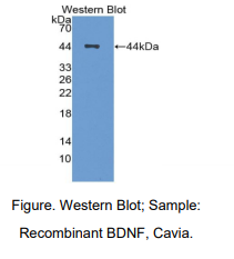 https://msimg.bioon.com/bionline/goods-no-pic.png