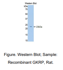 大鼠葡萄糖激酶调节蛋白(GKRP)多克隆抗体