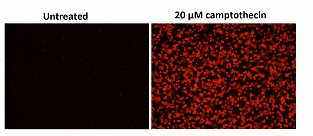 https://img.medsci.cn/e73eefcea40976357f460123cbf1e819c54e5106c9b457225be13b1cbc991aff.png