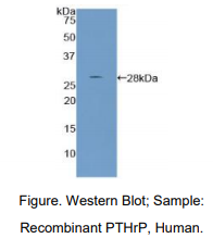 https://msimg.bioon.com/bionline/goods-no-pic.png