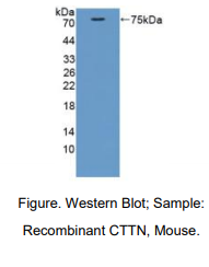 https://msimg.bioon.com/bionline/goods-no-pic.png