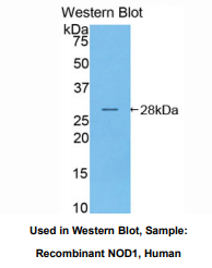 https://msimg.bioon.com/bionline/goods-no-pic.png