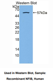 人核因子I/B(NFIB)多克隆抗体