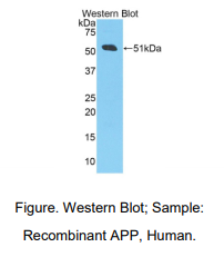 https://msimg.bioon.com/bionline/goods-no-pic.png