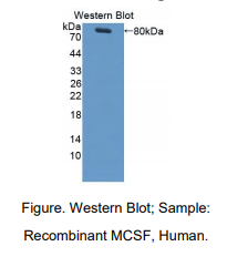 人巨噬细胞集落刺激因子(MCSF)多克隆抗体