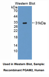 https://msimg.bioon.com/bionline/goods-no-pic.png