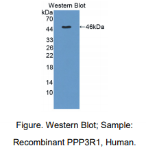 人蛋白磷酸酶3调节因子亚基1(PPP3R1)多克隆抗体