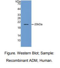 https://msimg.bioon.com/bionline/goods-no-pic.png