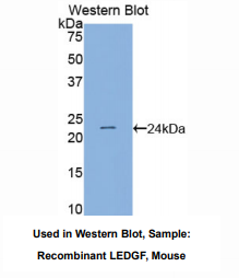 https://msimg.bioon.com/bionline/goods-no-pic.png