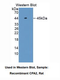 https://msimg.bioon.com/bionline/goods-no-pic.png